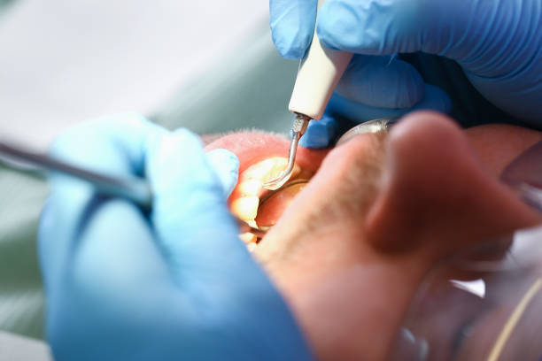 Emergency Dentist Open Today in NY