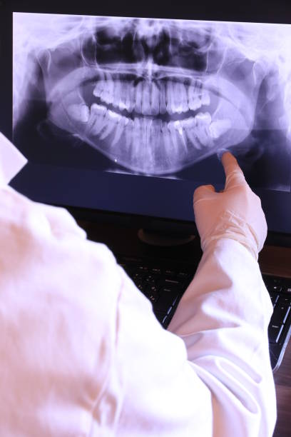 Teeth Whitening in NY