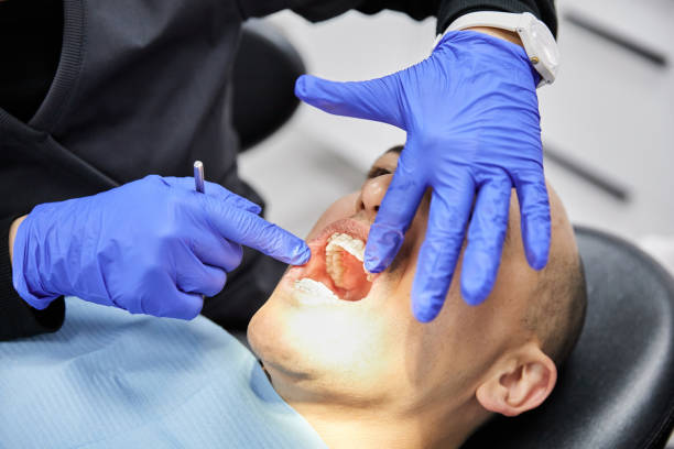 Best Knocked-Out Tooth Emergency  in Plattsburgh, NY